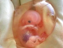 10 week fetus