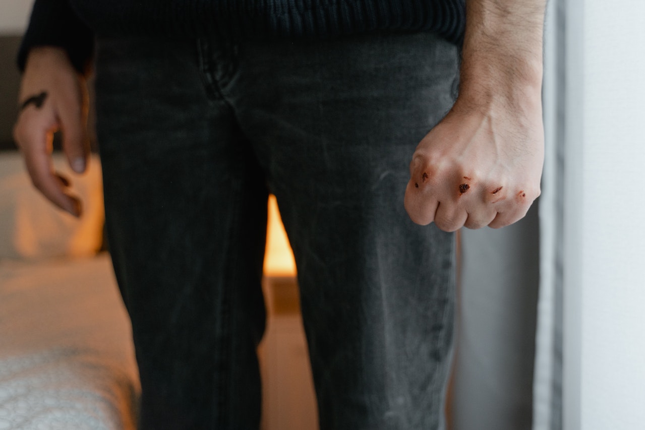 closeup of bloody knuckles