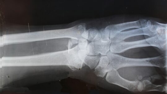 what to do if injured at work