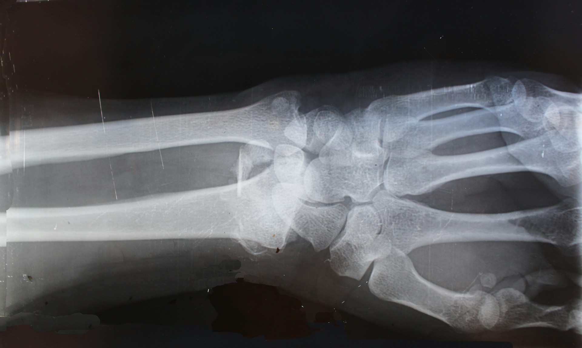 what to do if injured at work